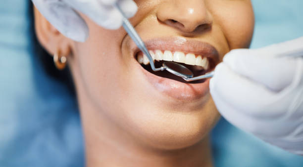 Best Emergency Tooth Extraction in Daingerfield, TX